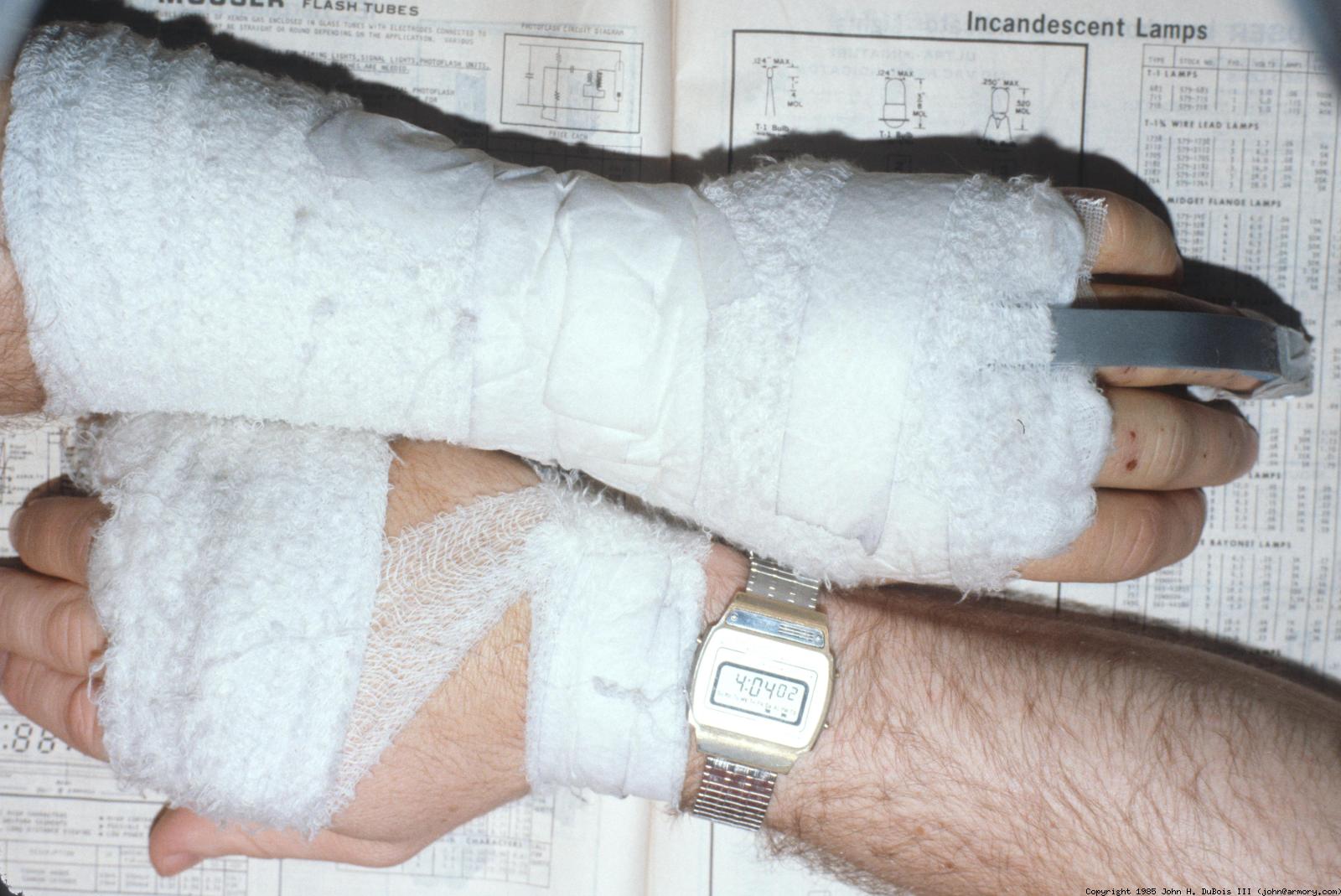 Bandaged Arms